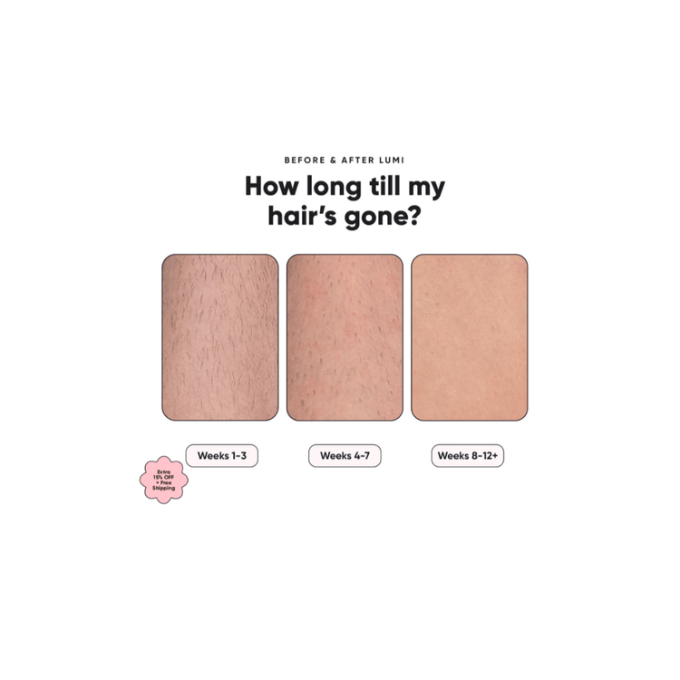 “IPL Hair Removal Handset Alisséa with packaging”