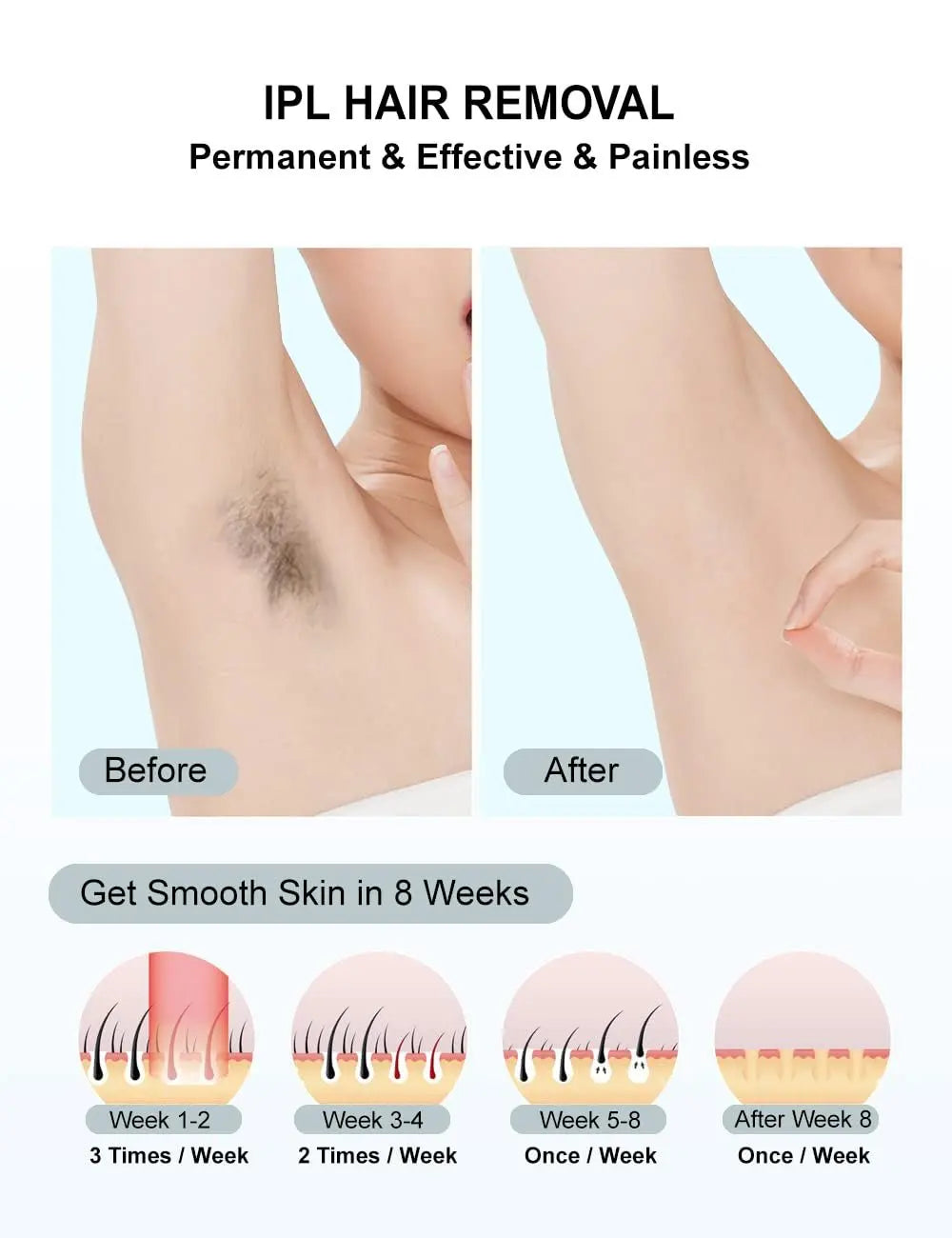 Gentle Touch IPL Hair Removal Device