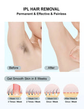 Gentle Touch IPL Hair Removal Device