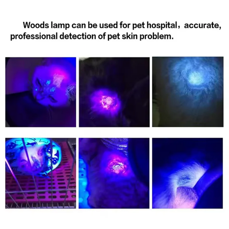 UV Skin Analyzer Device