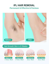 IPL Hair Removal Device
