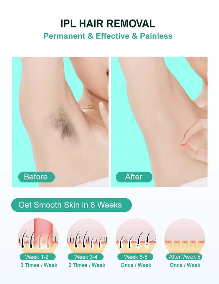 IPL Hair Removal Device
