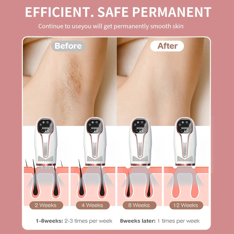 IPL Hair Removal Device 990000 Flashes