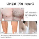 Professional IPL Laser Hair Remover