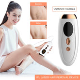 IPL Hair Removal Device