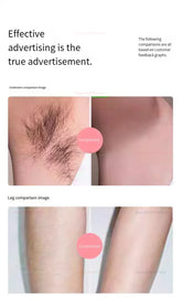 IPL Laser Hair Removal Device