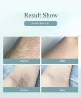 IPL Laser Hair Removal Device 990000 Flashes