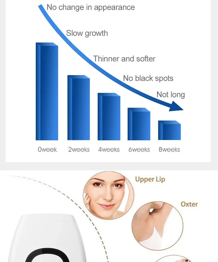 IPL Hair Removal Device