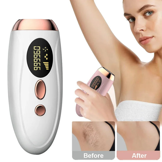 Laser Epilator IPL Hair Removal 990000 Flashes