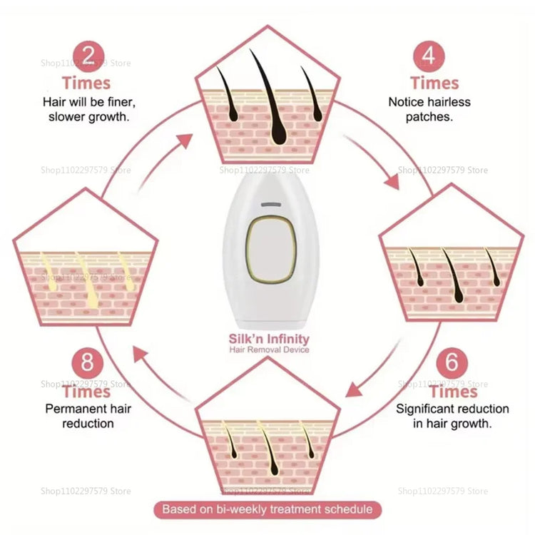 IPL Laser Hair Removal Device