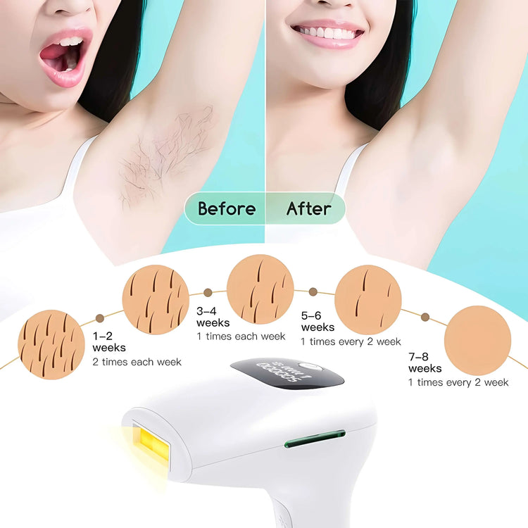 Reliable Results IPL Hair Removal Device