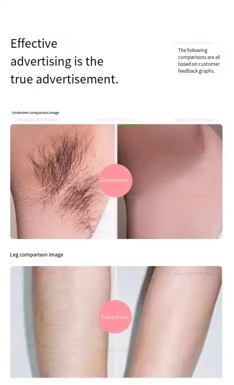 IPL Laser Hair Removal Device