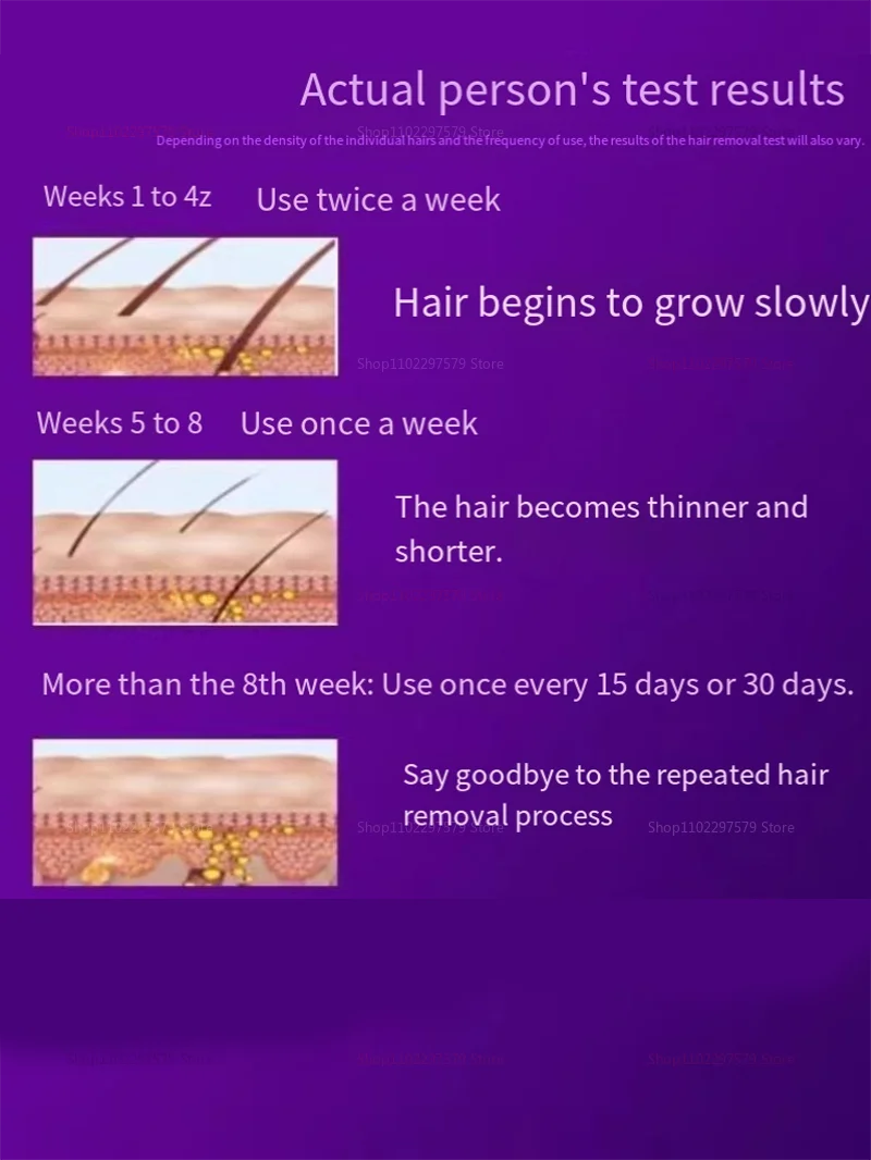 IPL Laser Hair Removal Device