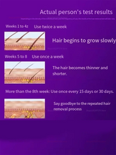 IPL Laser Hair Removal Device