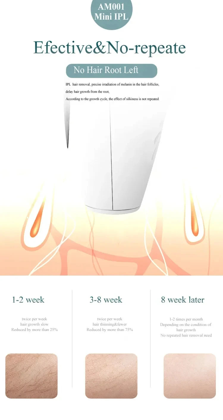 IPL Laser Hair Removal Device