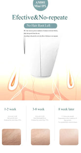IPL Laser Hair Removal Device