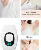 IPL Hair Removal Device
