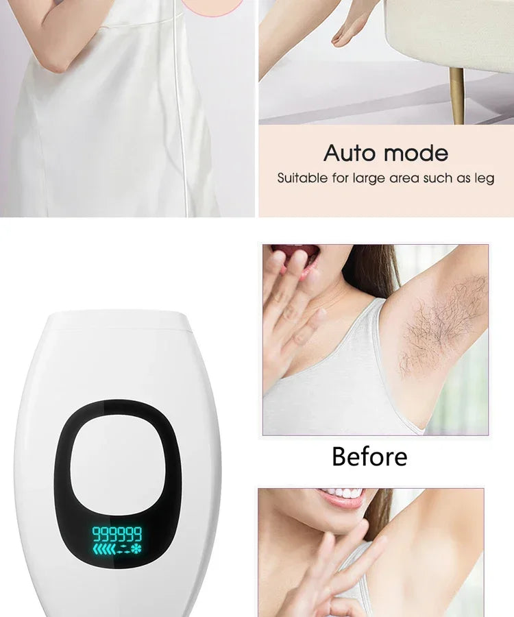 IPL Hair Removal Device