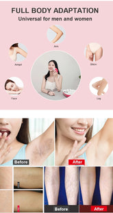 Professional IPL Hair Removal Device