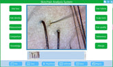 Smart Skin Analyzer