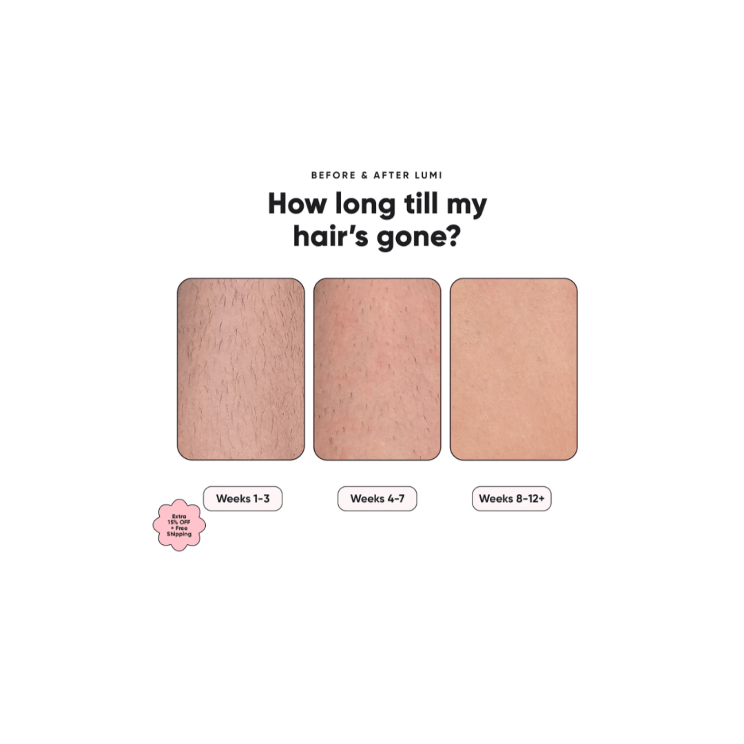 “IPL Hair Removal Handset Alisséa with packaging”